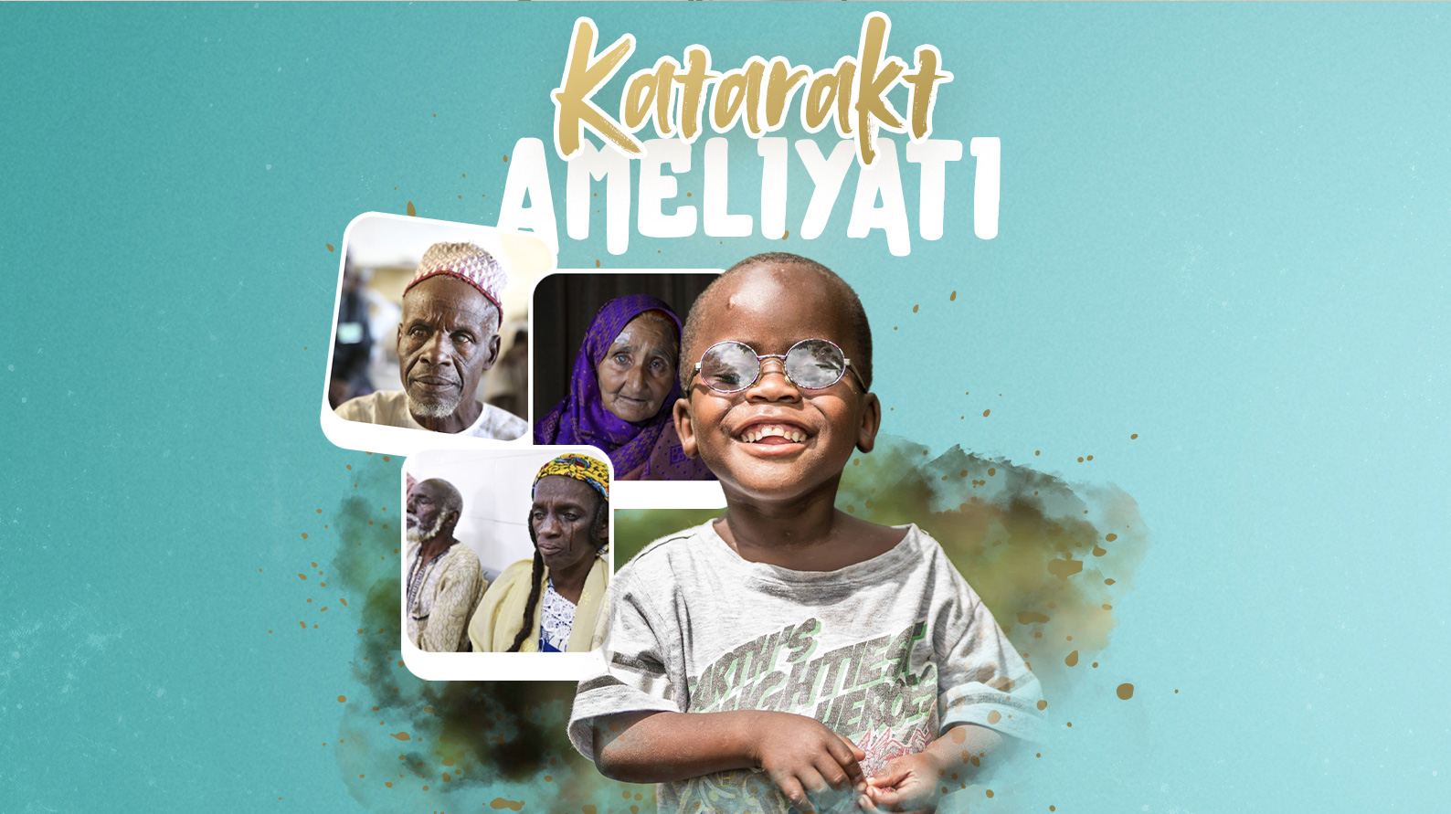 KATARAKT AMELİYATI